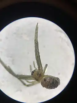 Juvenile Female Under Dissecting Microscope - Cairo, Egypt