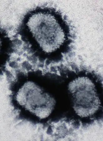 Electron micrograph of cowpox virus virions