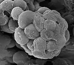 Creolimax fragrantissima, an ichthyosporean that infects peanut worms