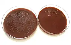 Colonies of Neisseria gonorrhoeae on agar bacterial culture plates