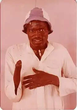 Shown is Garang Deng Bol, a Sudanese adult man wearing a white jalabiya layered over a T-shirt, with the T-shirt collar visible at the neckline. Bol is also wearing a striped hat with light and dark bands. Bol has a warm yet slightly hesitant expression. Bol's right arm is amputated just below the elbow, and their left hand is resting on their chest.