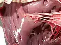 Papillary muscles and chordae tendineae