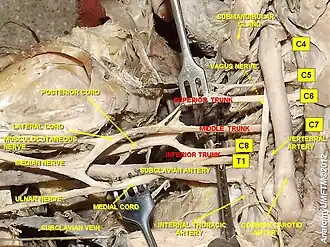 Brachial plexus and subclavian artery