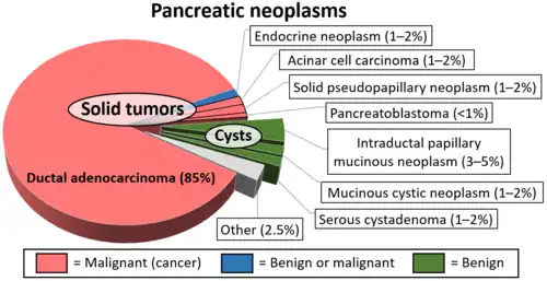 Relative incidence of various pancreatic neoplasms, with solid pseudopapillary neoplasm annotated at center right.[10]