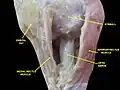 Extrinsic eye muscle. Nerves of orbita. Deep dissection.